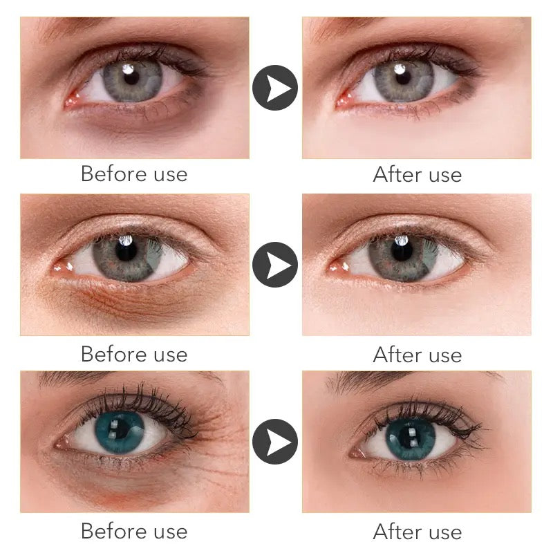Under Eye Patch for Wrinkles, eye bags, and more!